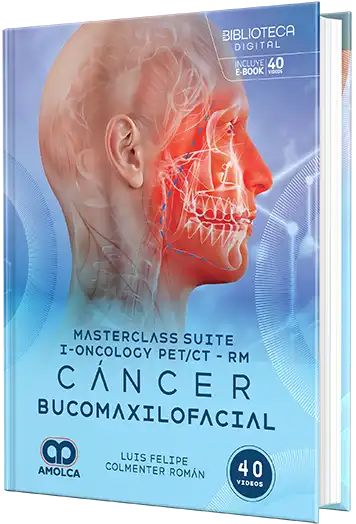 Cancer Mucomaxilofacial